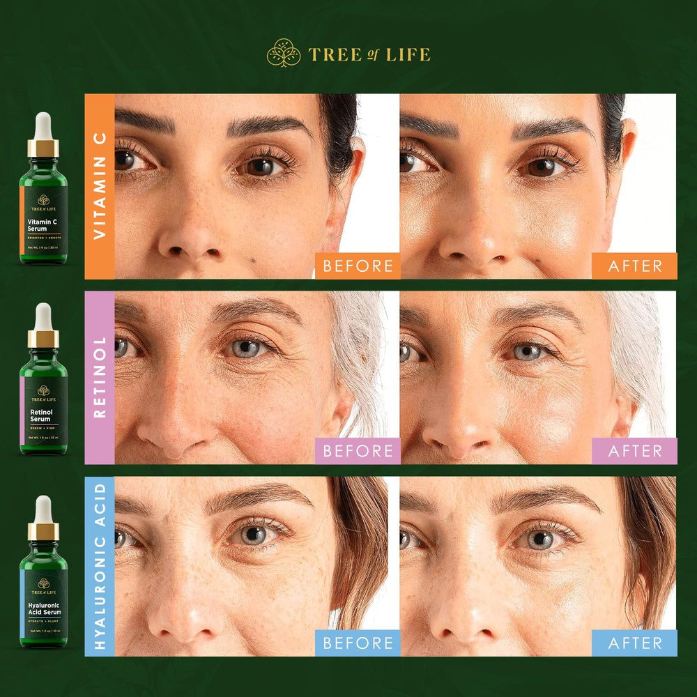 Tree of Life Beauty Peau sèche et sensible bénéficie d'une hydratation douce.