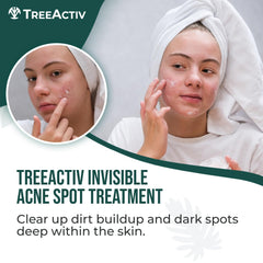 TreeActiv Crème point acné – application ciblée sur les zones concernées.