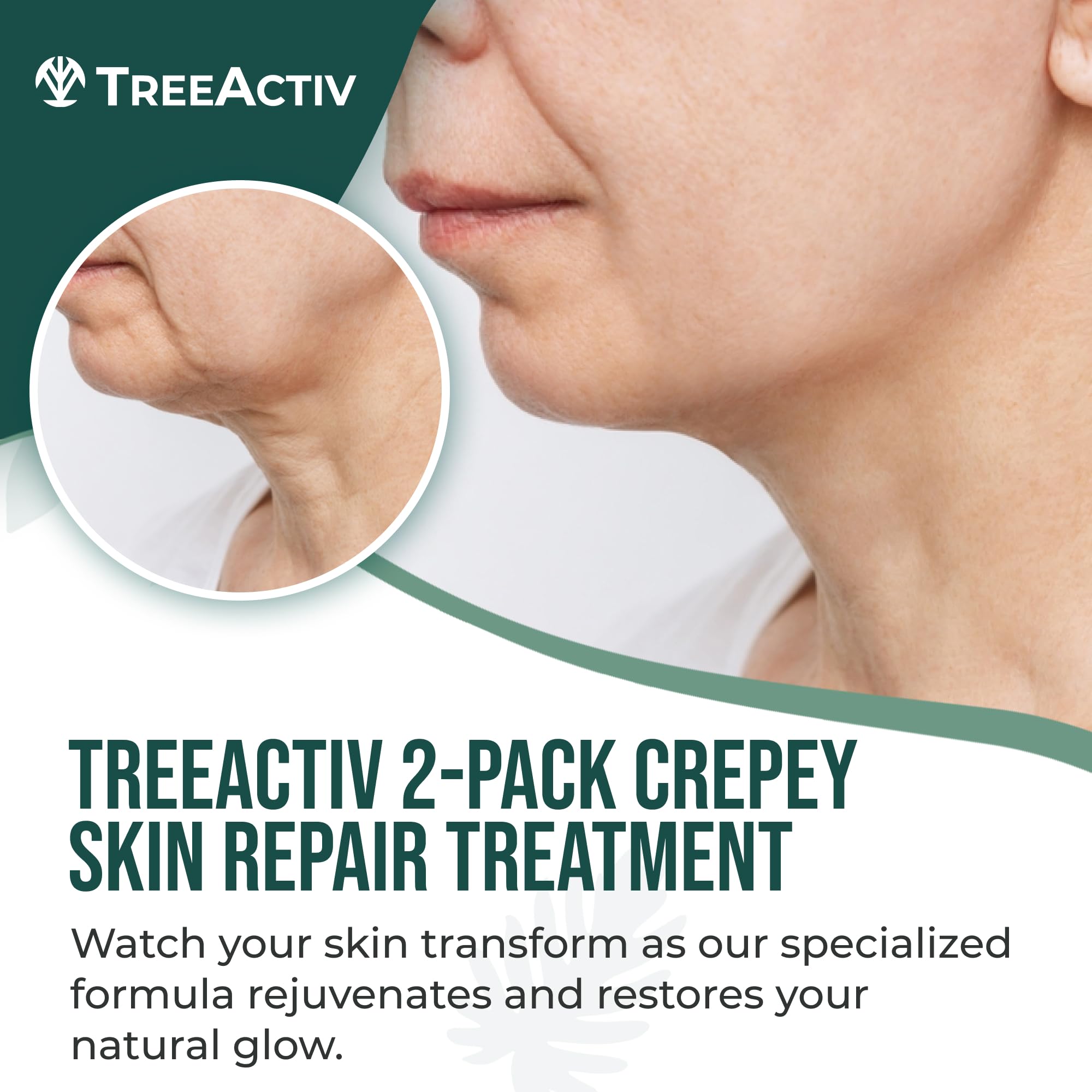 TreeActiv Crème hyaluronique, hydratation en profondeur pour peau sèche.