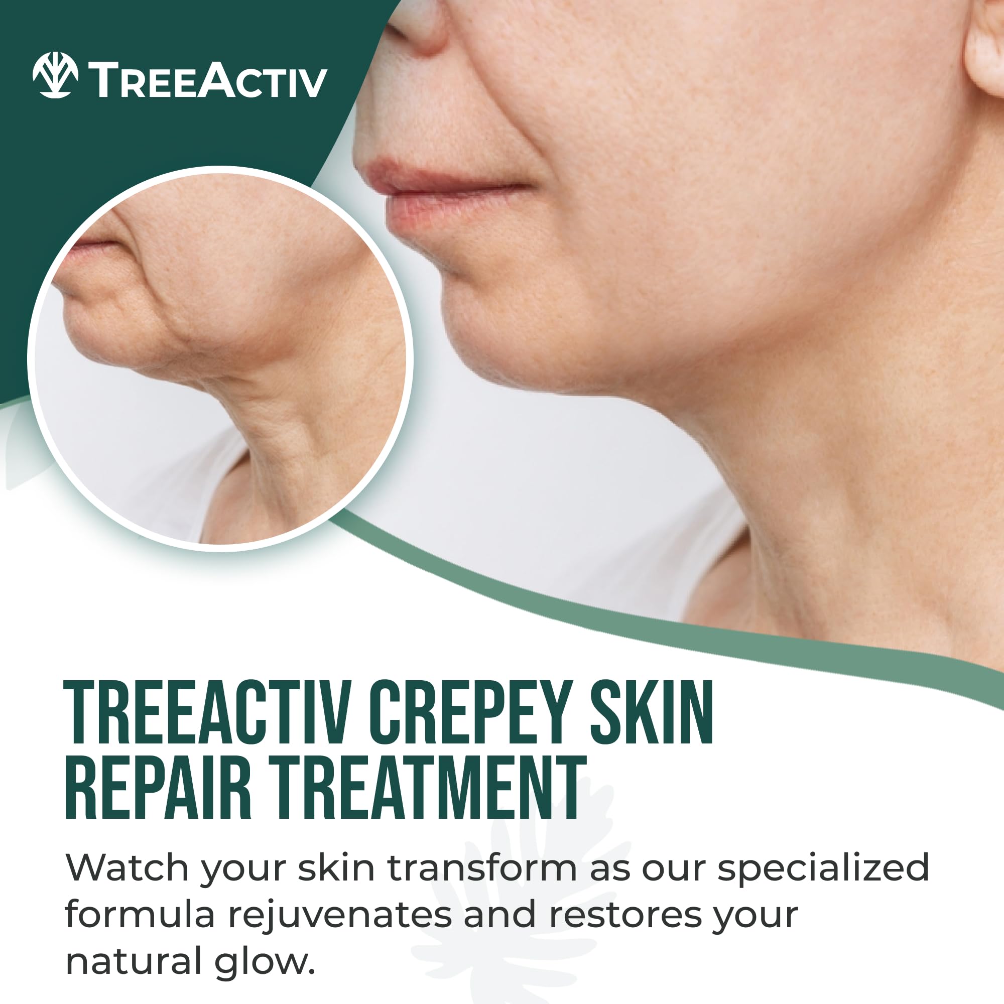 TreeActiv Crème crepée - texture onctueuse illustrant l'effet hydratant sur la peau