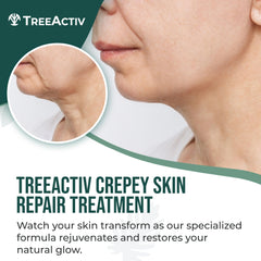 TreeActiv Crème crepée - texture onctueuse illustrant l'effet hydratant sur la peau
