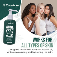 TreeActiv lotion dos antiacné, soin ciblé et hydratation adaptée.