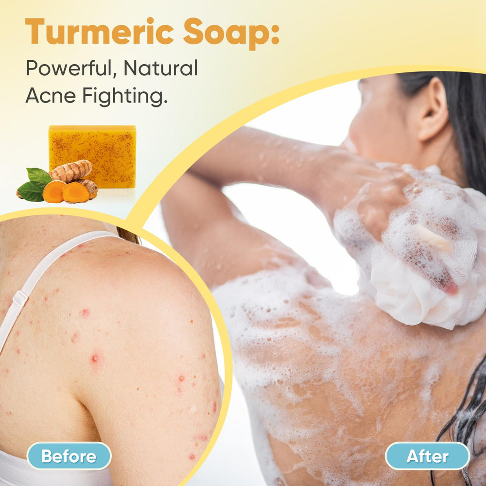 Treeroot savon turmeric mousse dense: mousse riche pour une expérience luxueuse.