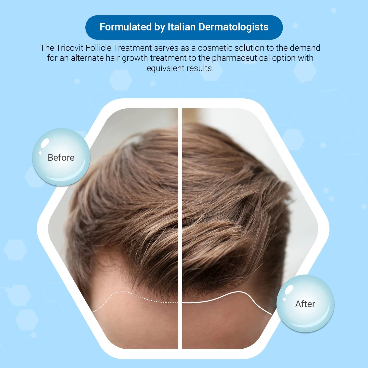 Tricovit Forte lotion capillaire texture légère pour cheveux propres et sains.