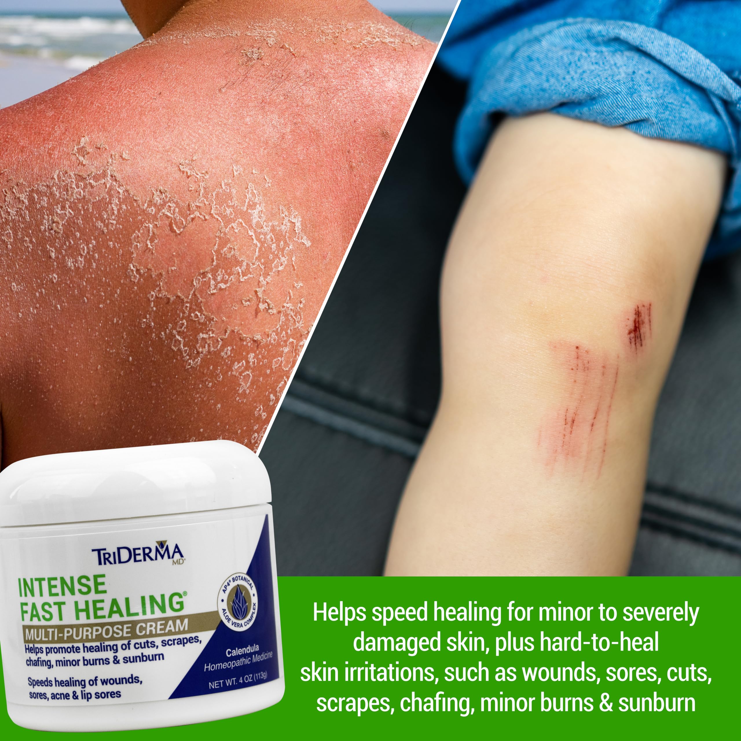TriDerma Crème Apaisement Inflammation – flacon visible, peut aider à apaiser inconforts légers