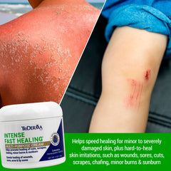 TriDerma Crème Apaisement Inflammation – flacon visible, peut aider à apaiser inconforts légers