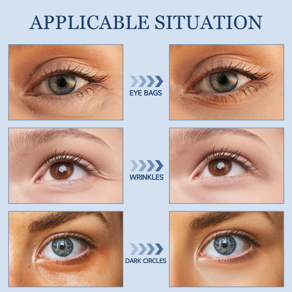 TRIMYFITER crème contour des yeux, application en U pour rafraîchir.