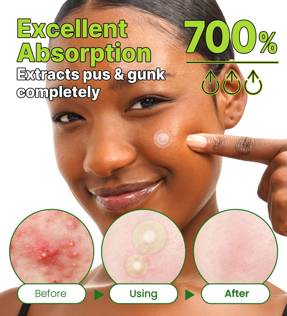 Easy application on clean, dry skin for fast use