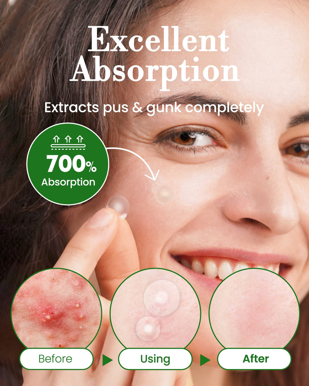 Pansement Troubless imperméable à l'eau, idéal pendant les activités.