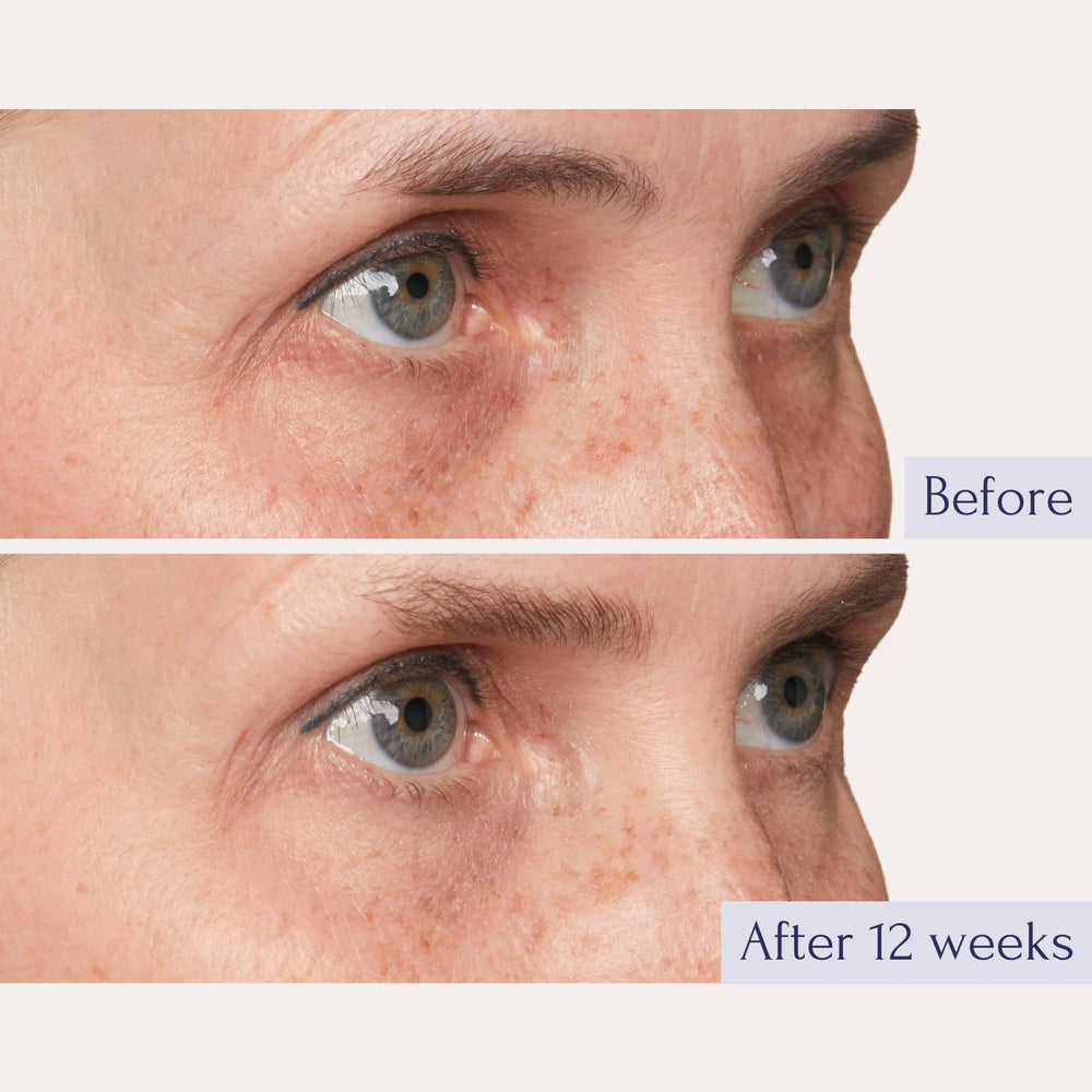 Effet repulpant de Tru Alchemy Elixir Yeux grâce à l’acide hyaluronique