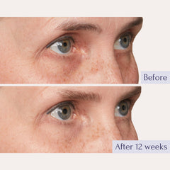 Effet repulpant de Tru Alchemy Elixir Yeux grâce à l’acide hyaluronique