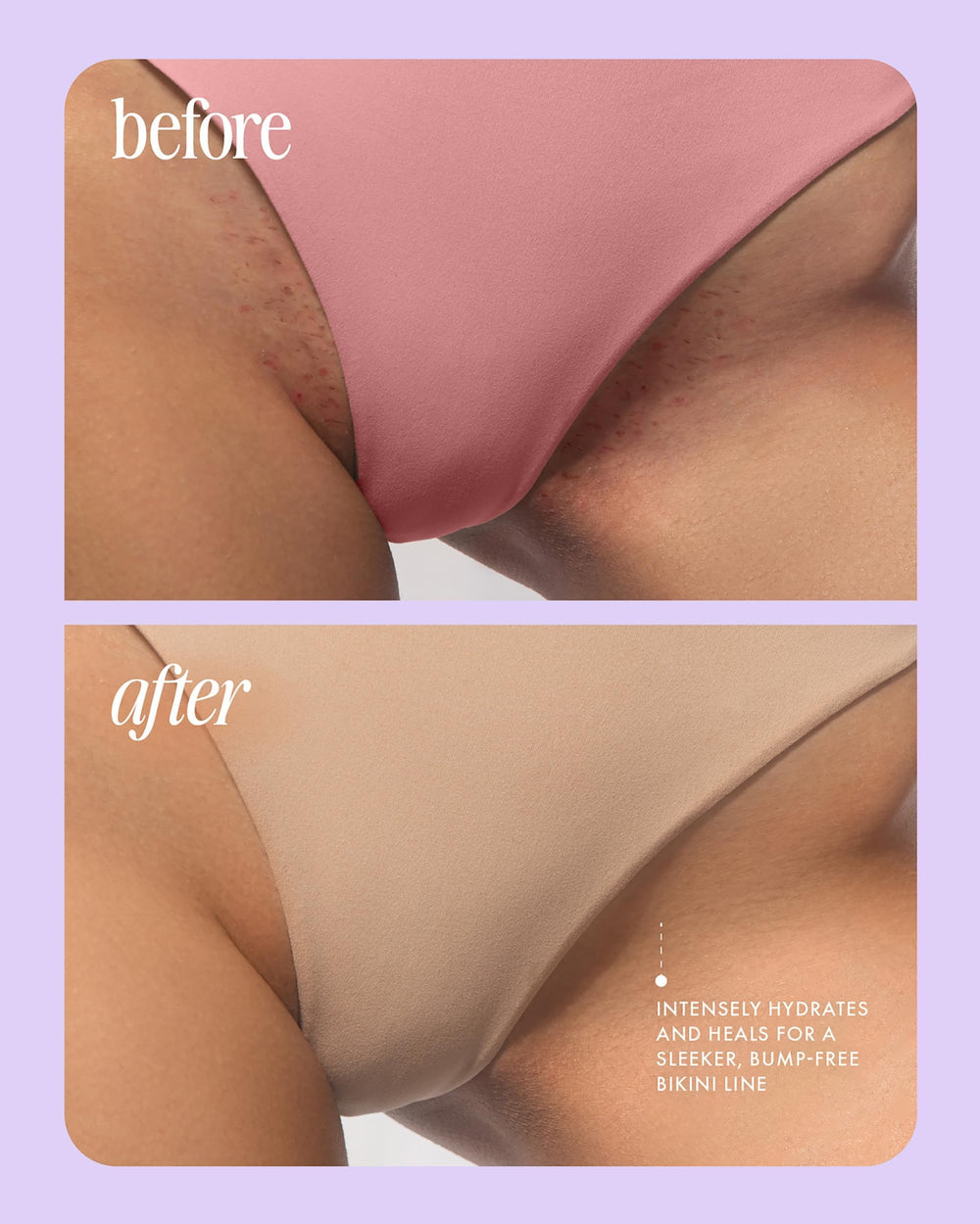 Truly Glazed Donut – format compact idéal sac et voyage pour soins express.