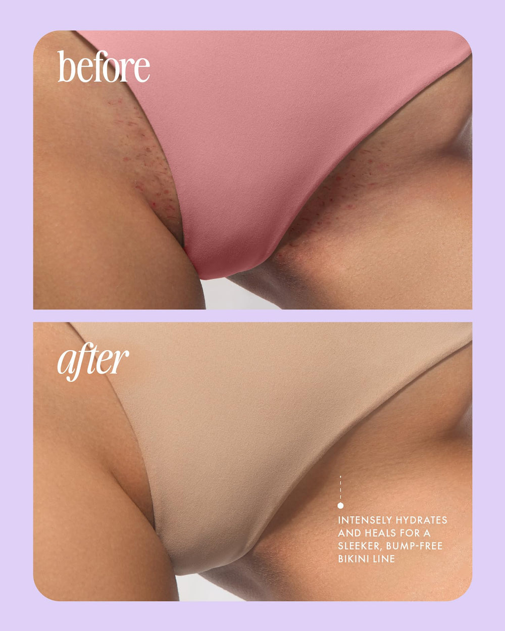 Truly Beauty Donut glace huile post-rasage: contenu niacinamide bénéfique