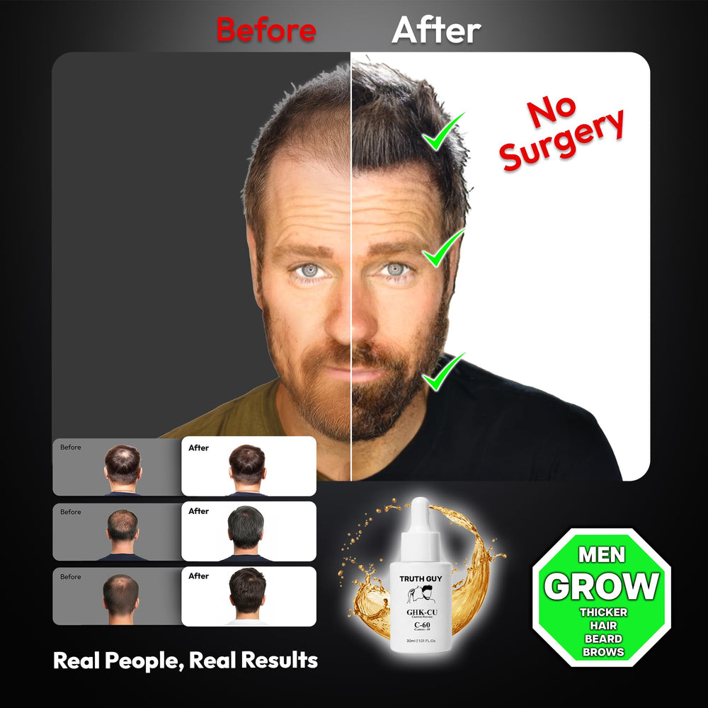 Truth Guy sérum application scalp, stimule les follicules capillaires.