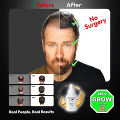 Truth Guy sérum application scalp, stimule les follicules capillaires.