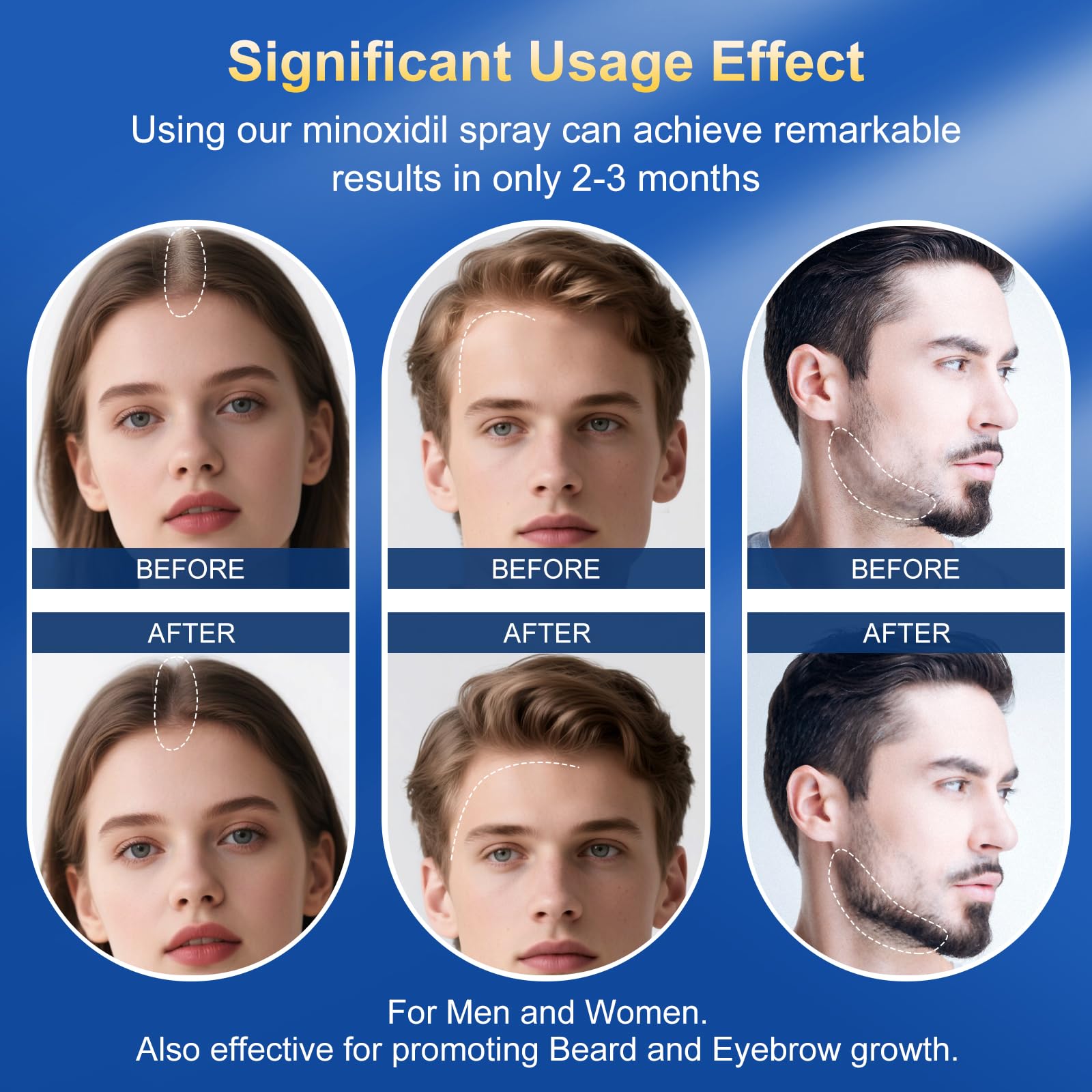 Bec ergonomique Trzsfr vise les zones sans altérer la coiffure.