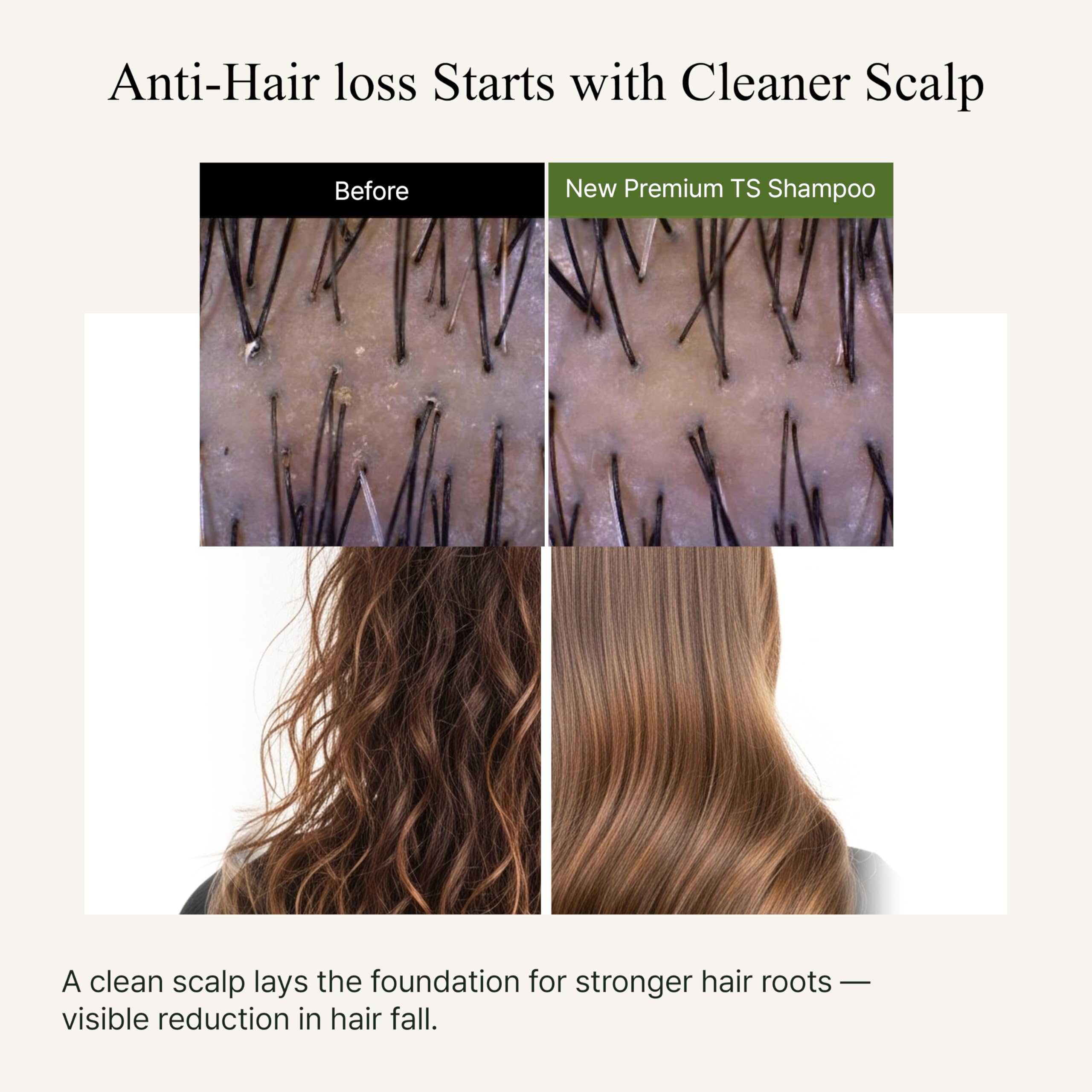 19 extraits botaniques affichés sur l’étiquette du TS SHAMPOO