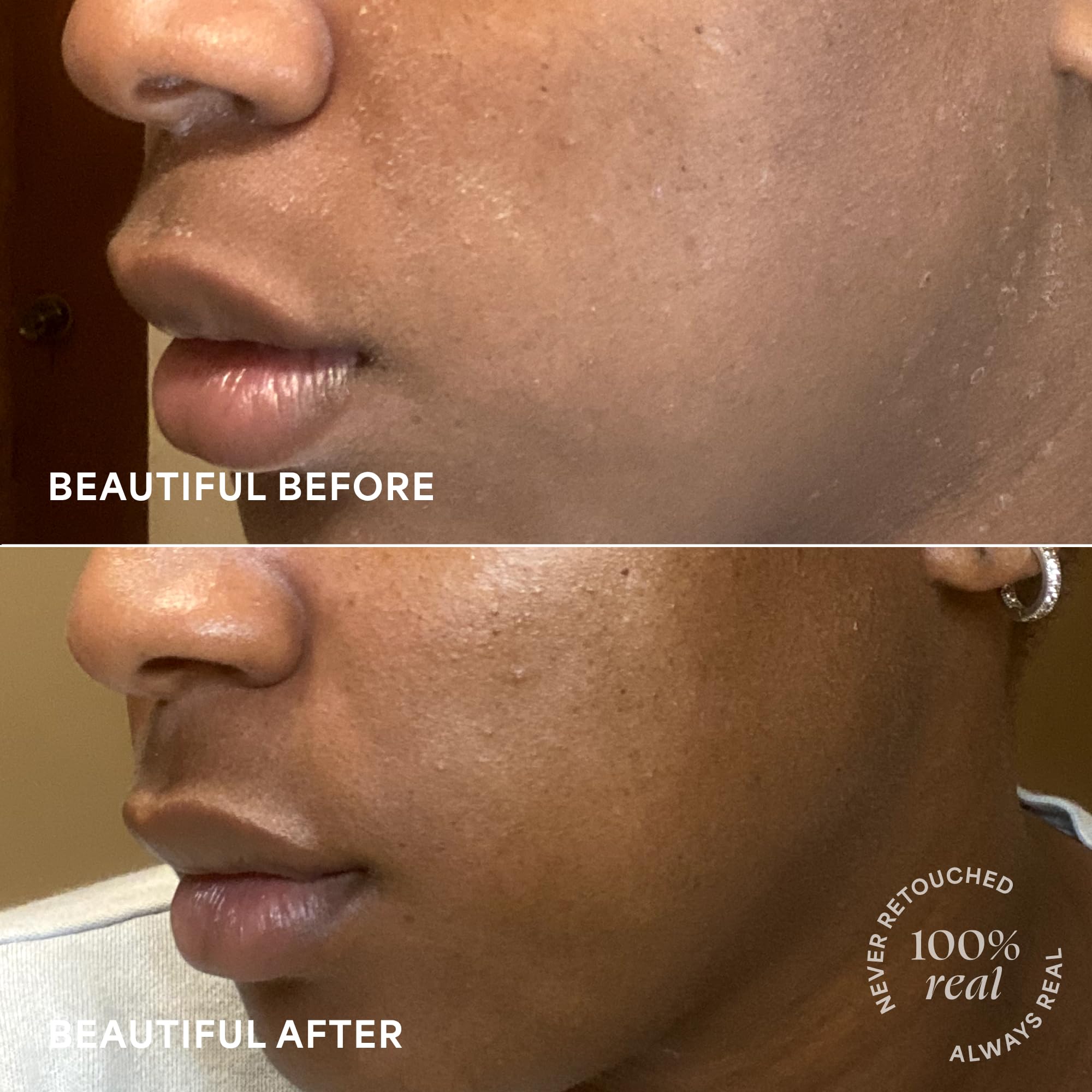 Probiotic-inspired ingredients aimed at healthier skin texture.
