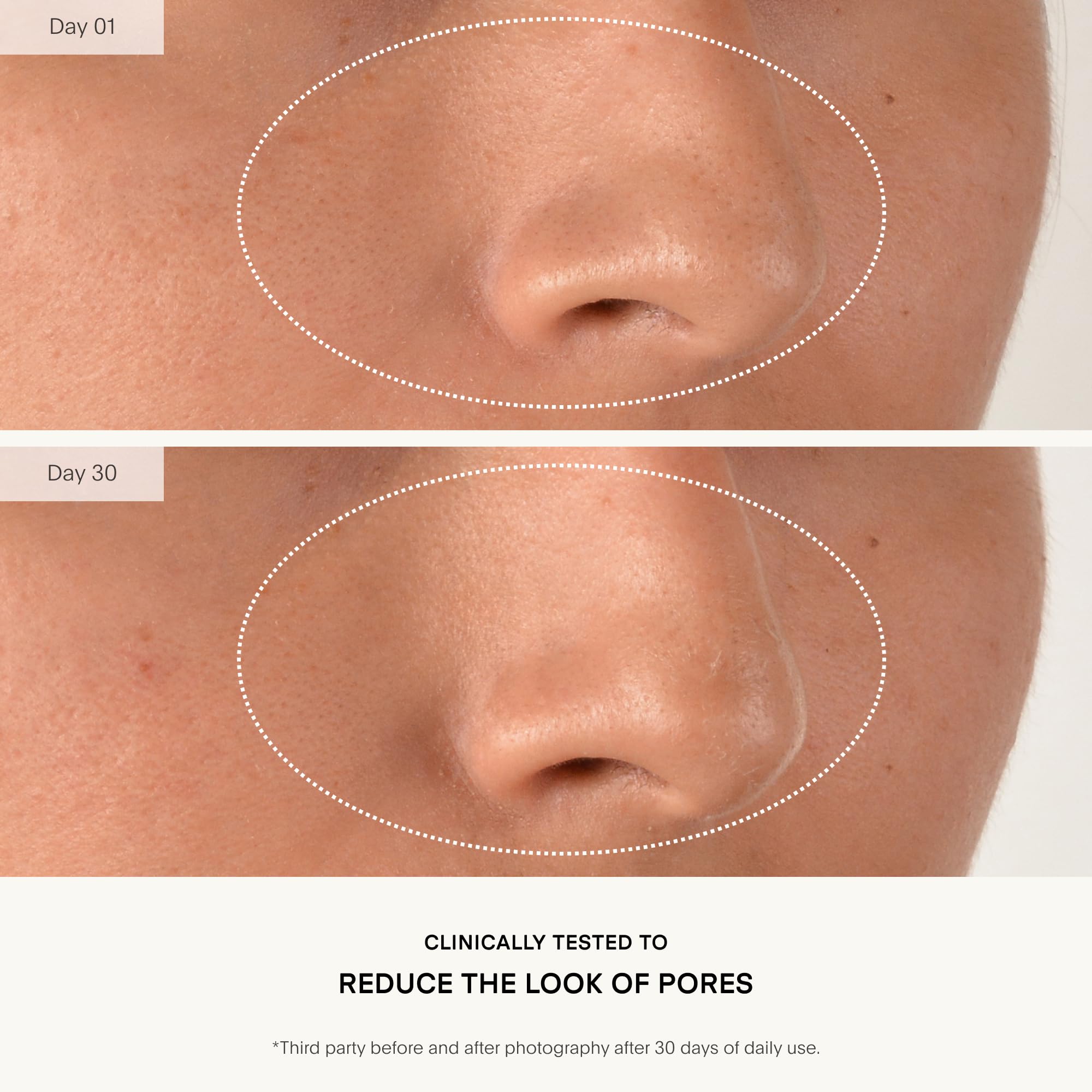 Huile de jojoba dans U Beauty Resurfacing Compound Serum nourrit la peau.