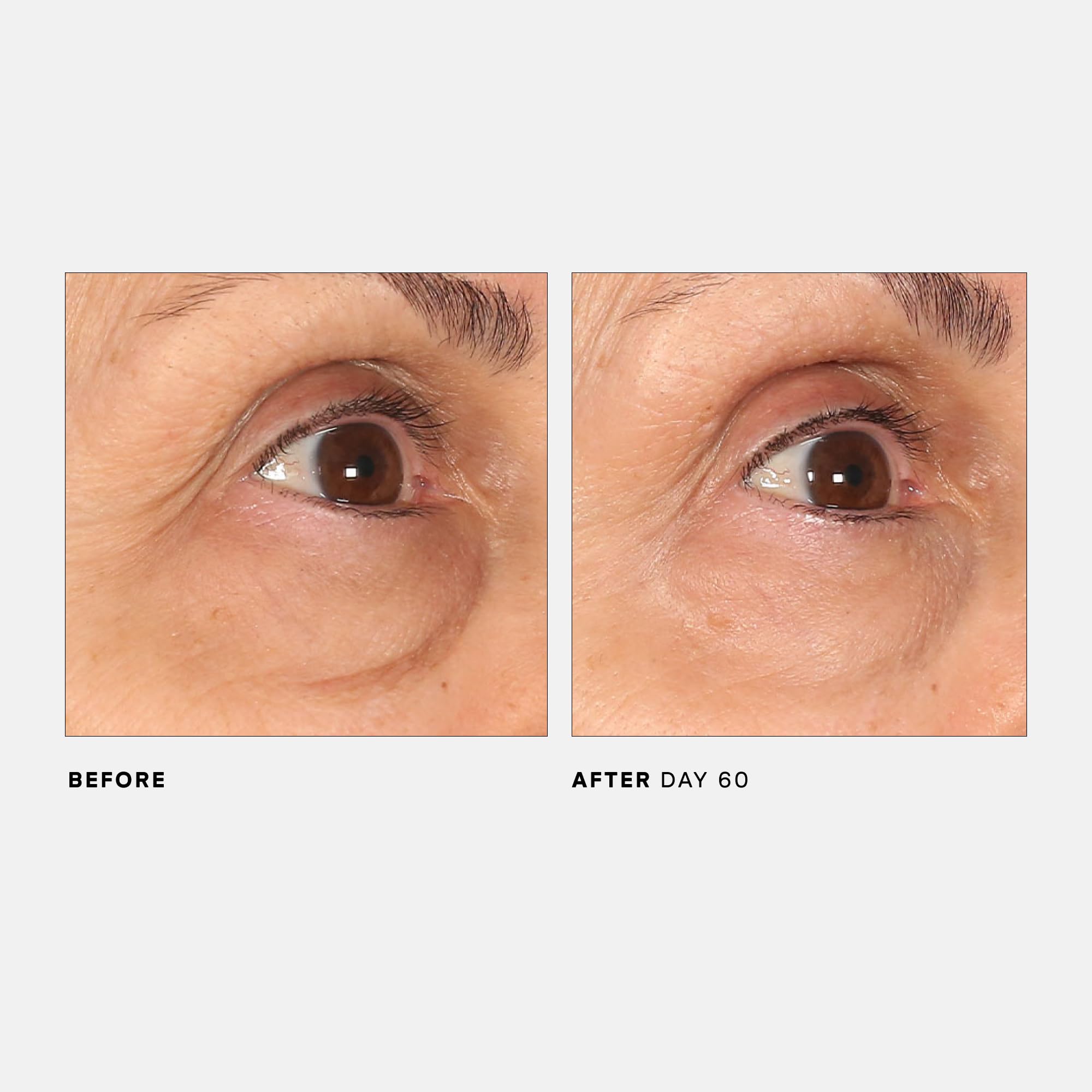 U Beauty Return Eye Concentrate facilite l'application et améliore l'hydratation au quotidien