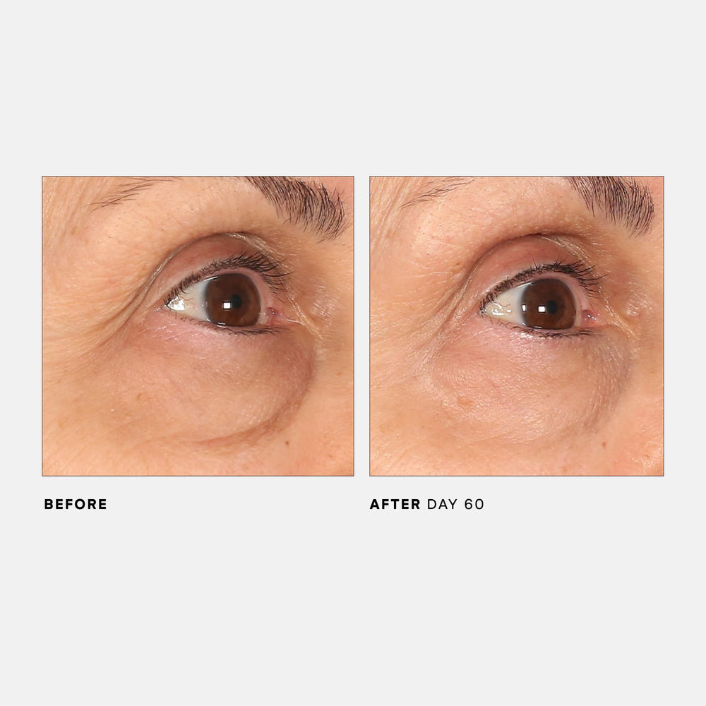 U Beauty Return Eye Concentrate facilite l'application et améliore l'hydratation au quotidien