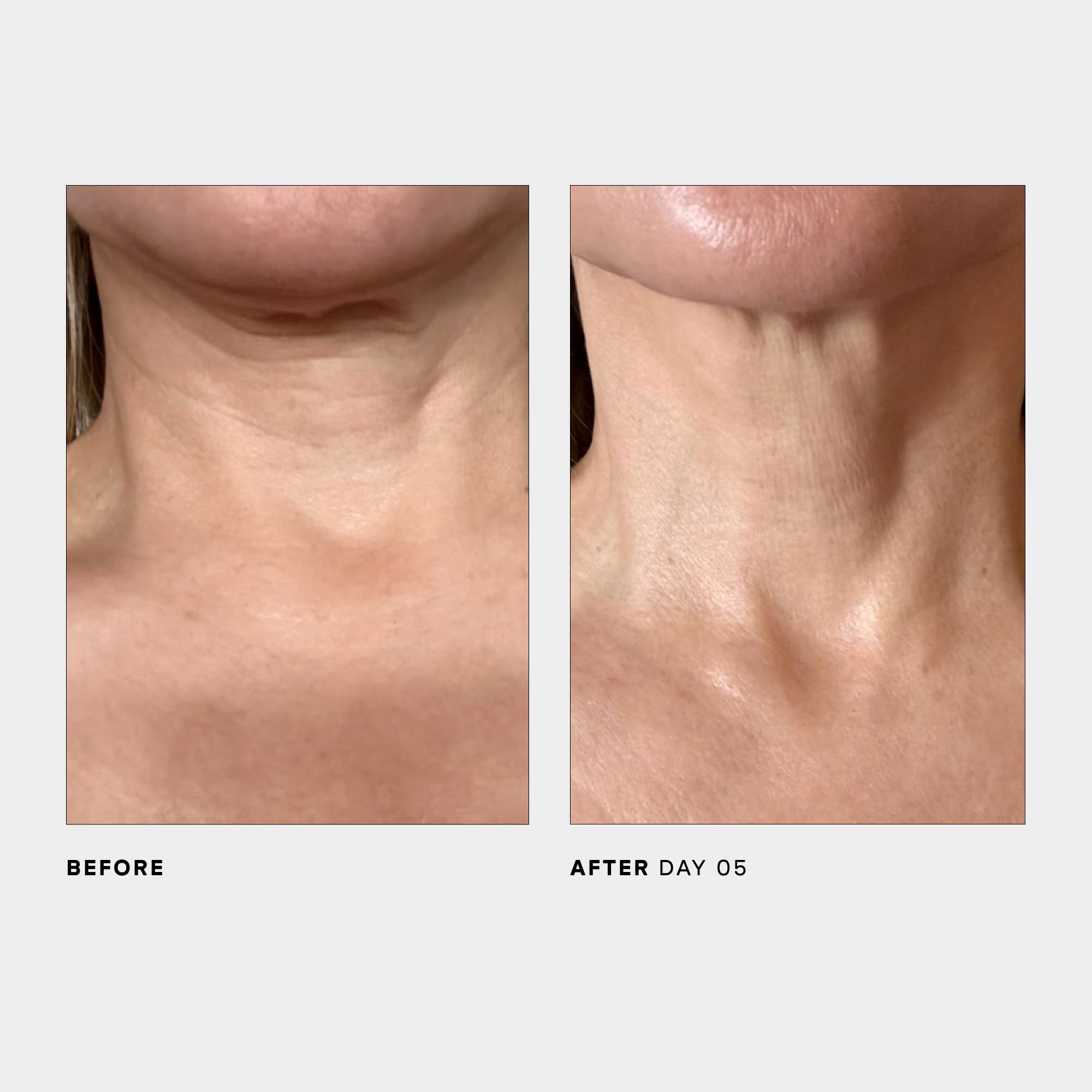Design d'emballage élégant de U Beauty SCULPT Neck décolleté.