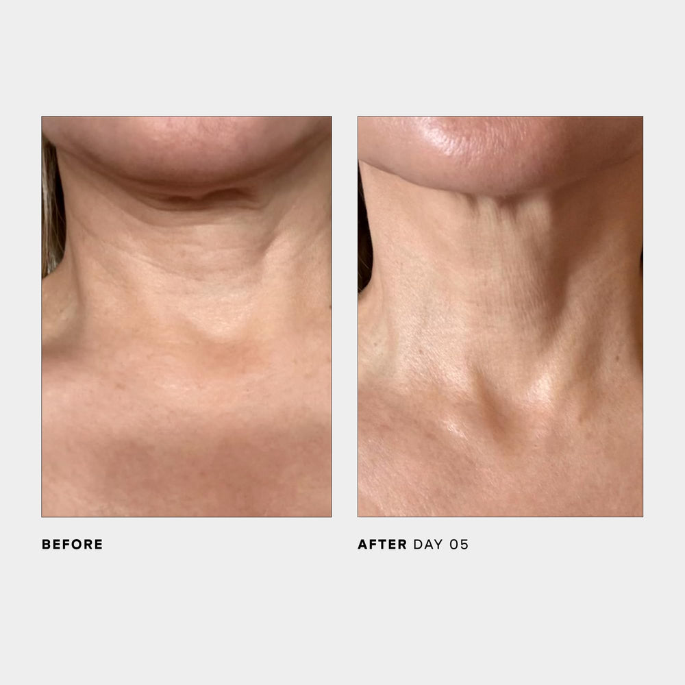 Design d'emballage élégant de U Beauty SCULPT Neck décolleté.