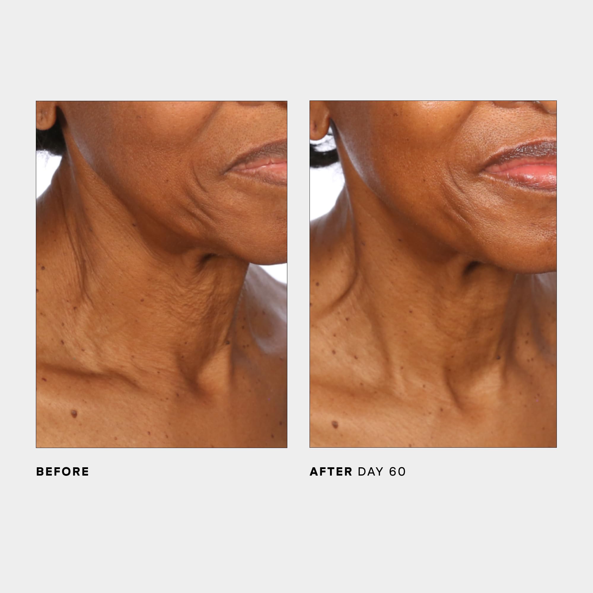 Rituel quotidien SCULPT Neck décolleté pour peau plus lisse et tonifiée.