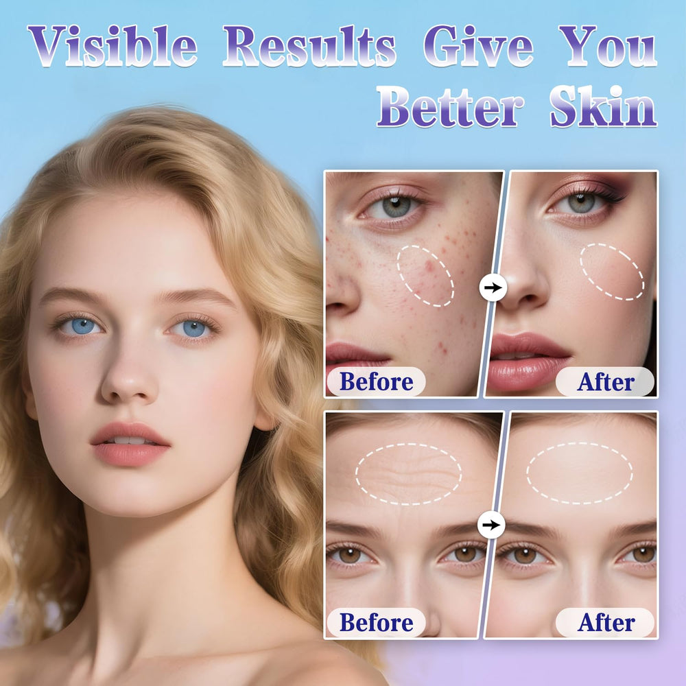 Uaike Derma Stamp: cuir-chevelu stimulé et routine domestique efficace.