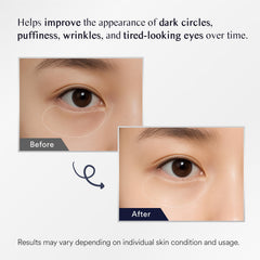 Patchs yeux refroidissants Uikeaft offrant un rafraîchissement instantané.