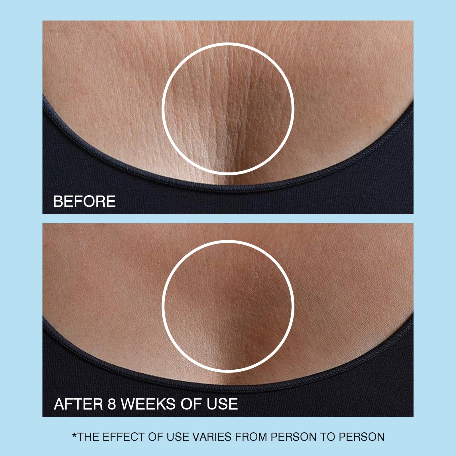 ujhay crème cou soin nourrissant : nourrissant et lissant la peau du cou.