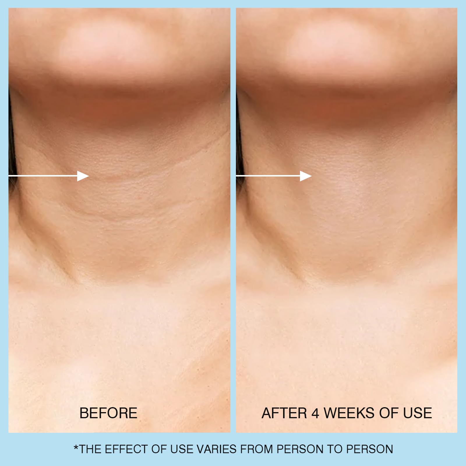 ujhay crème cou texture legere : hydratation légère adaptée à tous types de peau.