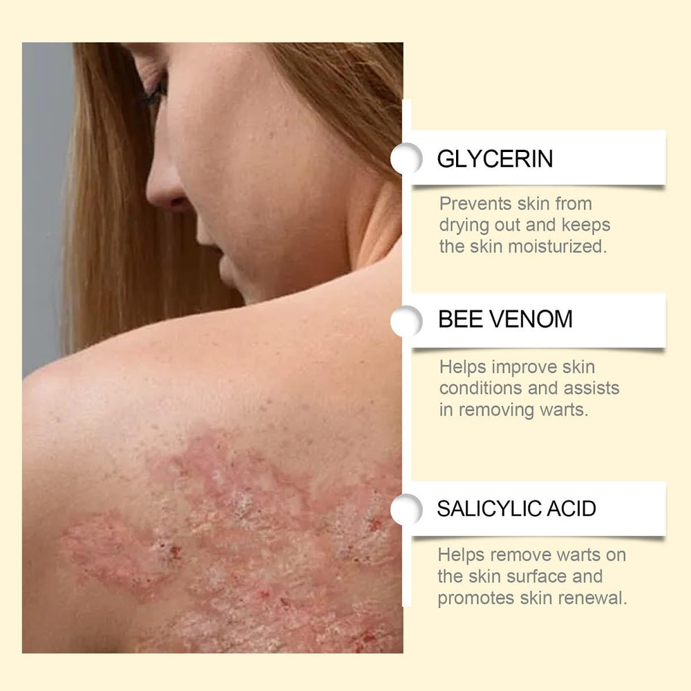 UKDVRL Crème Venin Abeille – application douce en massage sur peau.