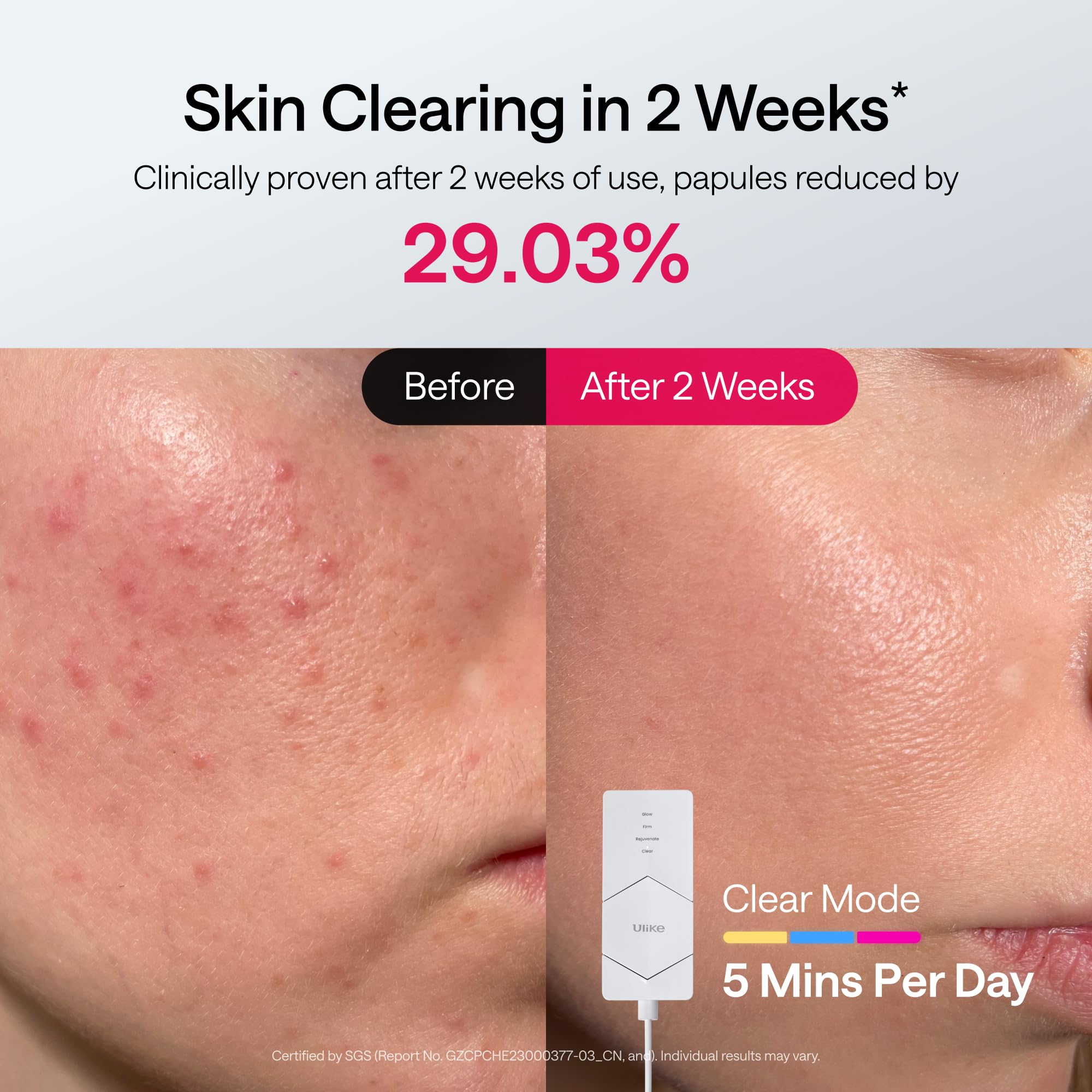 Ulike ReGlow lumière infrarouge : mode Rejuvenate pour peau revitalisée.