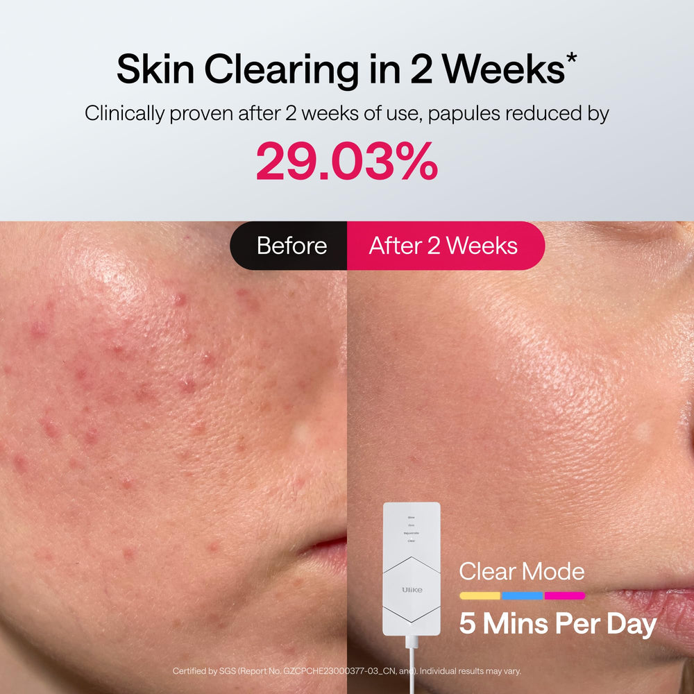 Ulike ReGlow lumière infrarouge : mode Rejuvenate pour peau revitalisée.