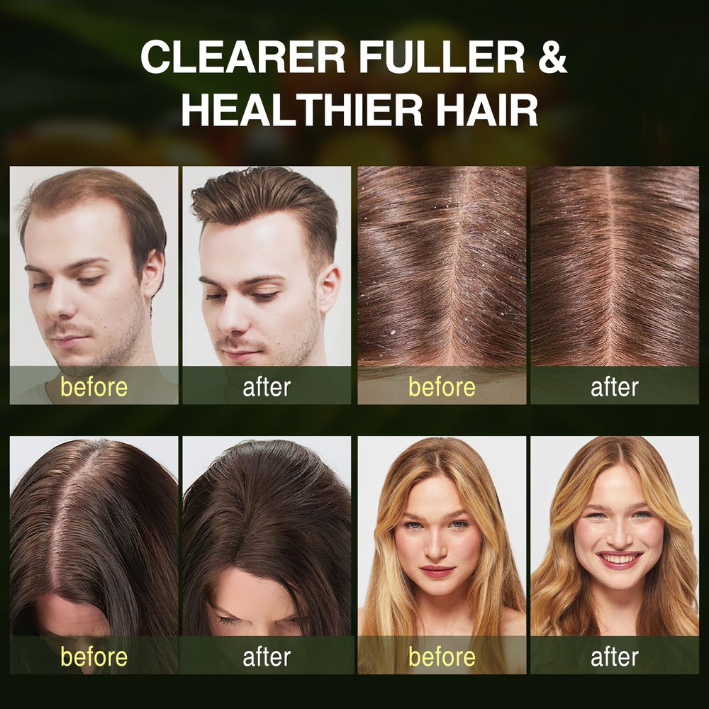 ulluxe-batana-hair-growth-shampoo-huile-batana : nourrit en profondeur et revitalise les longueurs.
