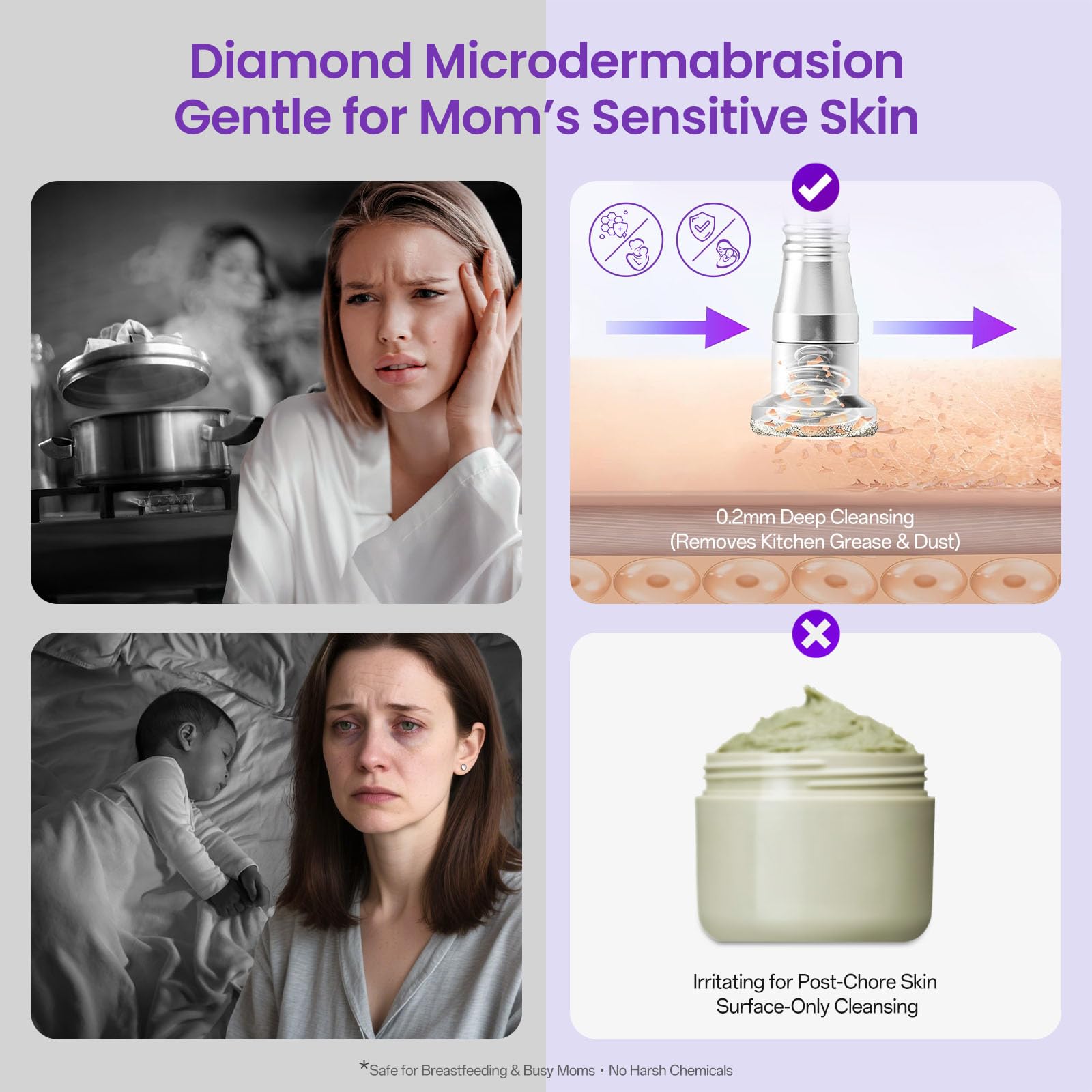 Têtes diamant de différentes finitions pour UNOISETION Diamond Microdermabrasion.