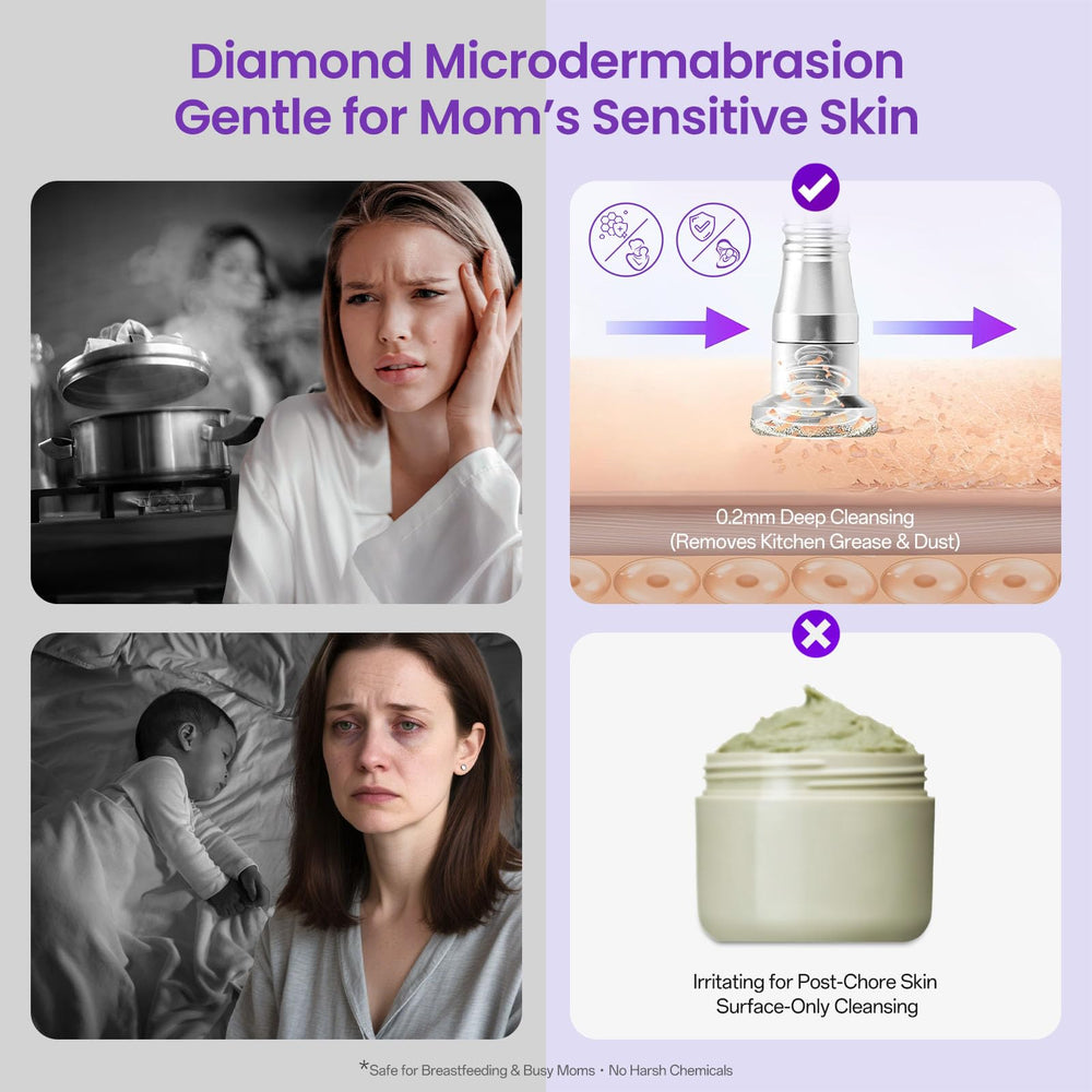 Têtes diamant de différentes finitions pour UNOISETION Diamond Microdermabrasion.