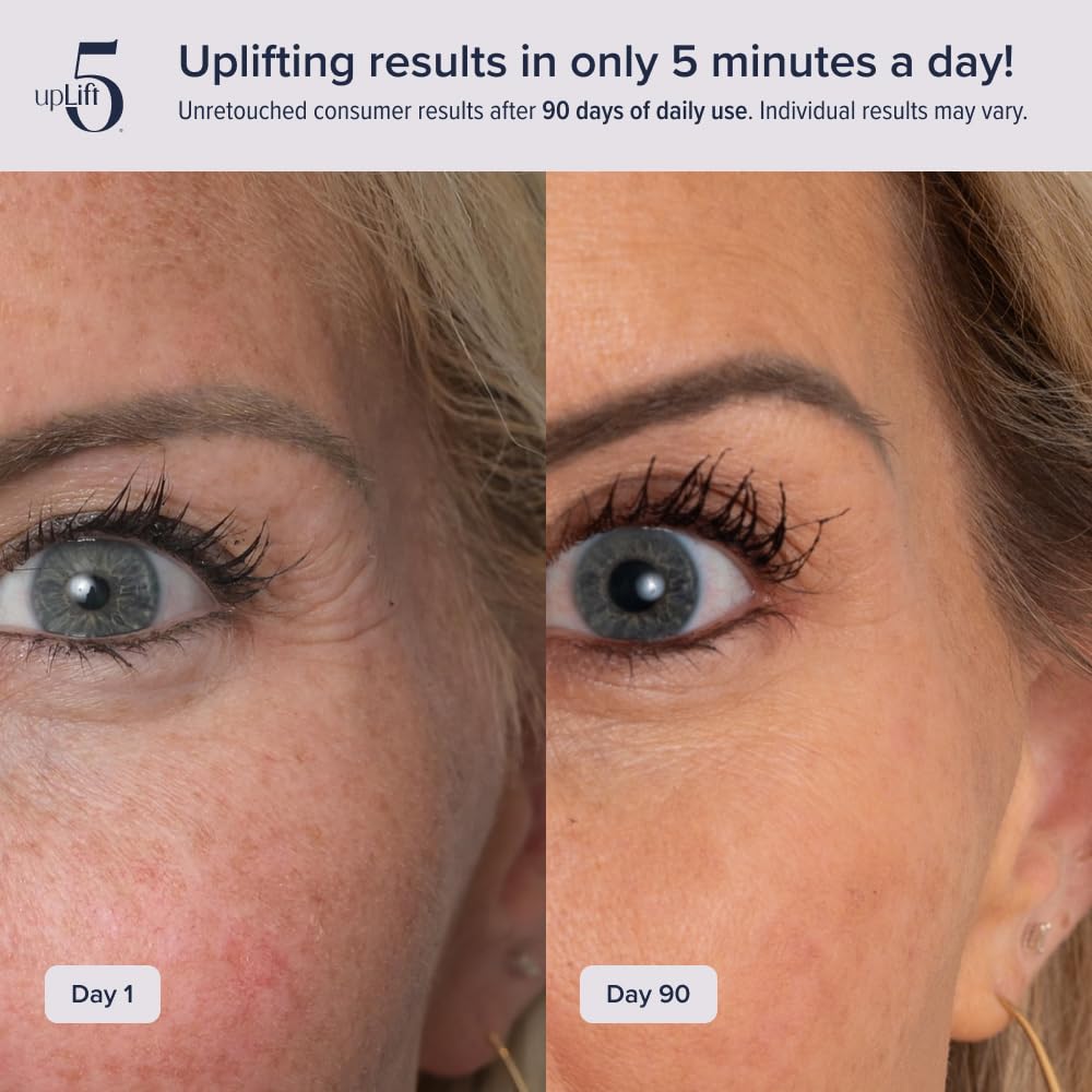 UpLift 5 – contours du visage plus définis après l'utilisation.