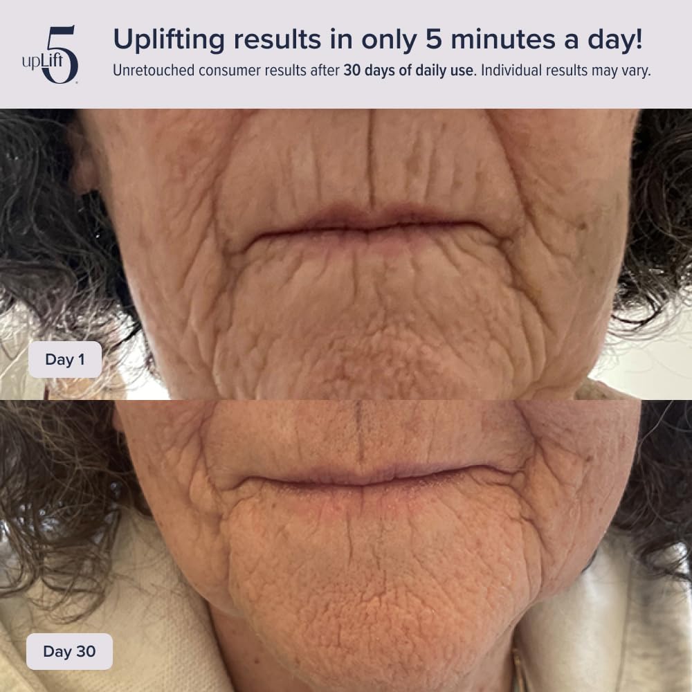 UpLift 5 – routine quotidienne sans chirurgie pour raffermir le visage.