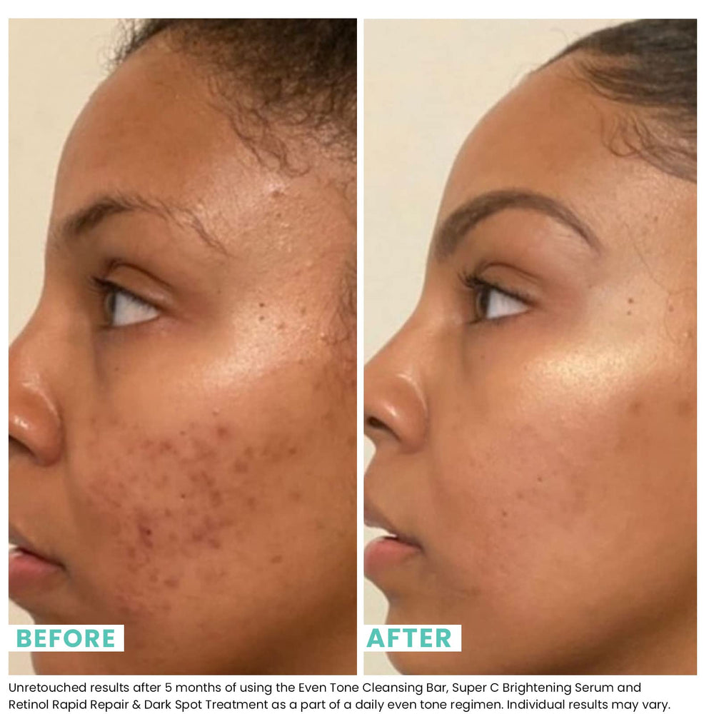 Mousse crémeuse produite par la barre Urban Skin Rx Even Tone pour nettoyage quotidien