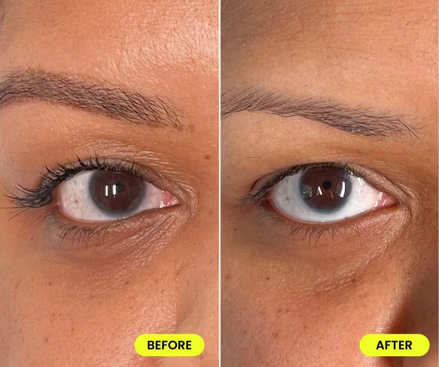 Urban Skin Rx vitamine C et retinol, ingrédients phares pour l éclat et la texture