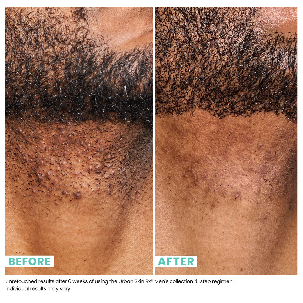 Urban Skin Rx Homme – emballage élégant prêt pour une routine quotidienne.