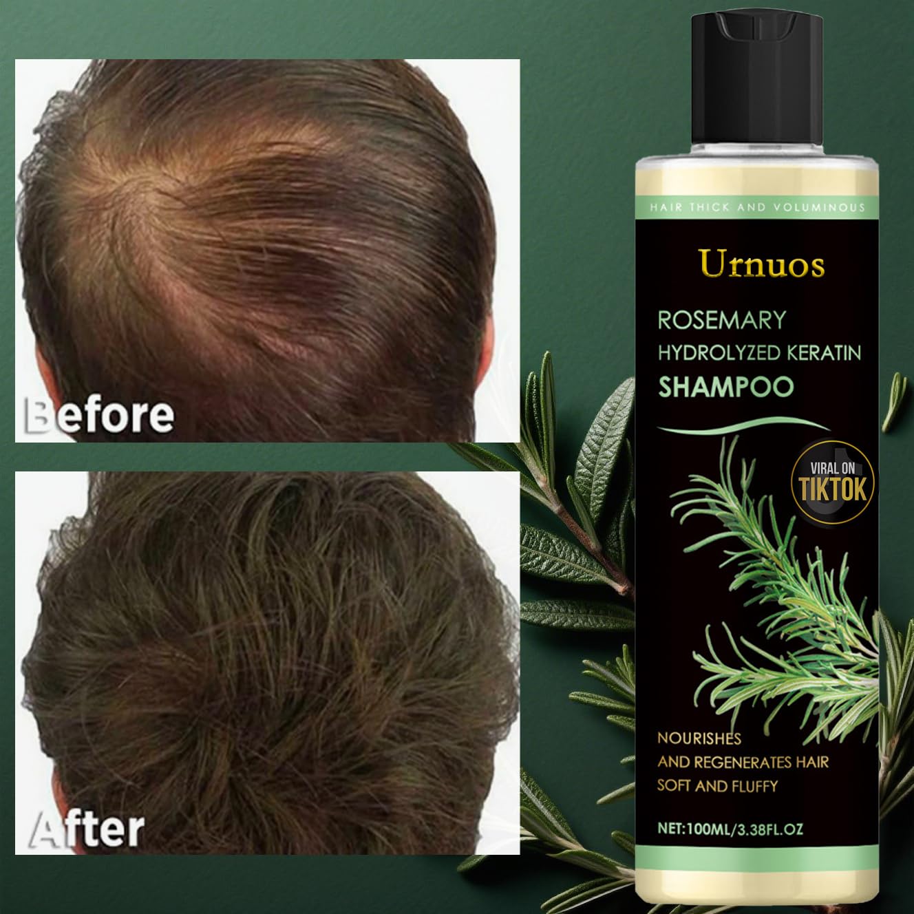 Urnuos Ingrédients romarin huile essentielle, soin nourrissant du cuir chevelu