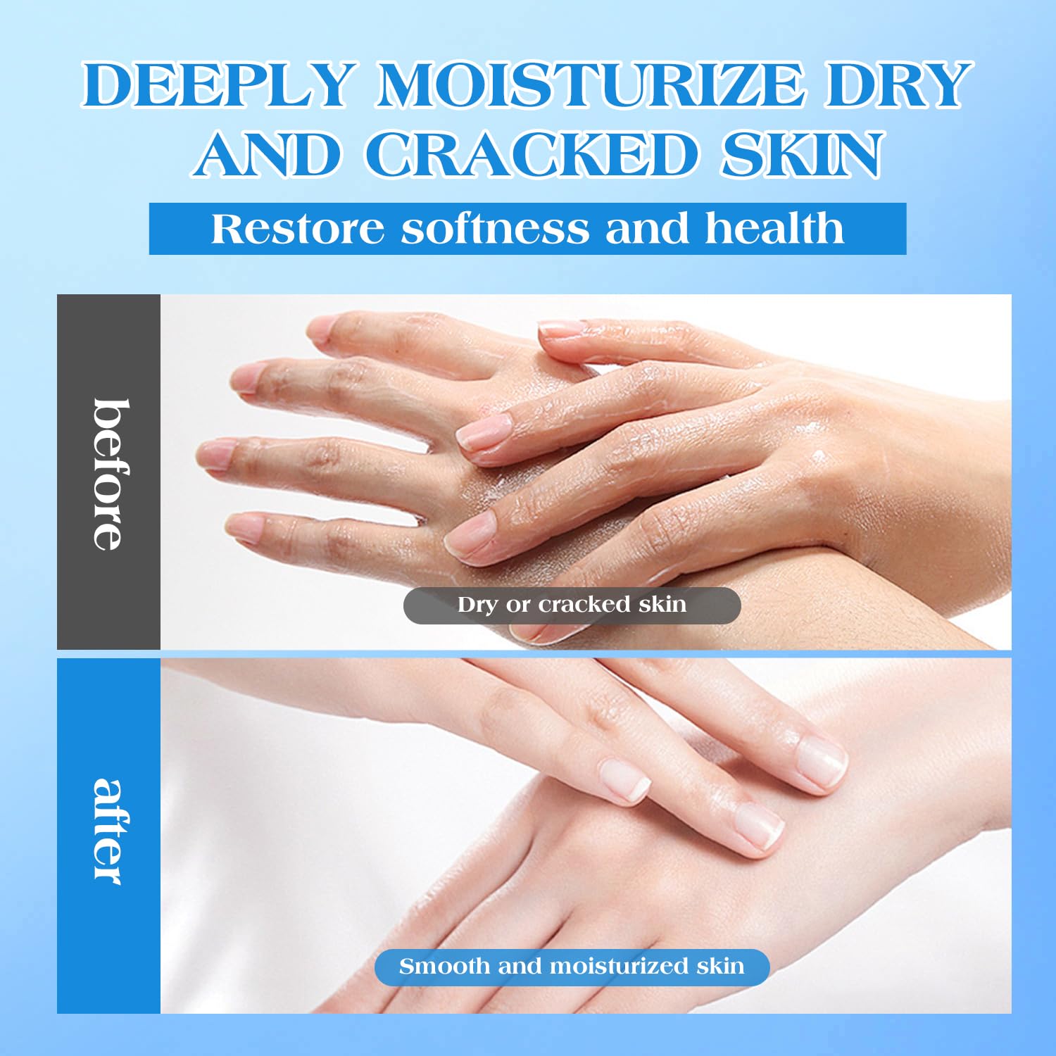 URQT Crème Urea 42% application rapide, absorption rapide.