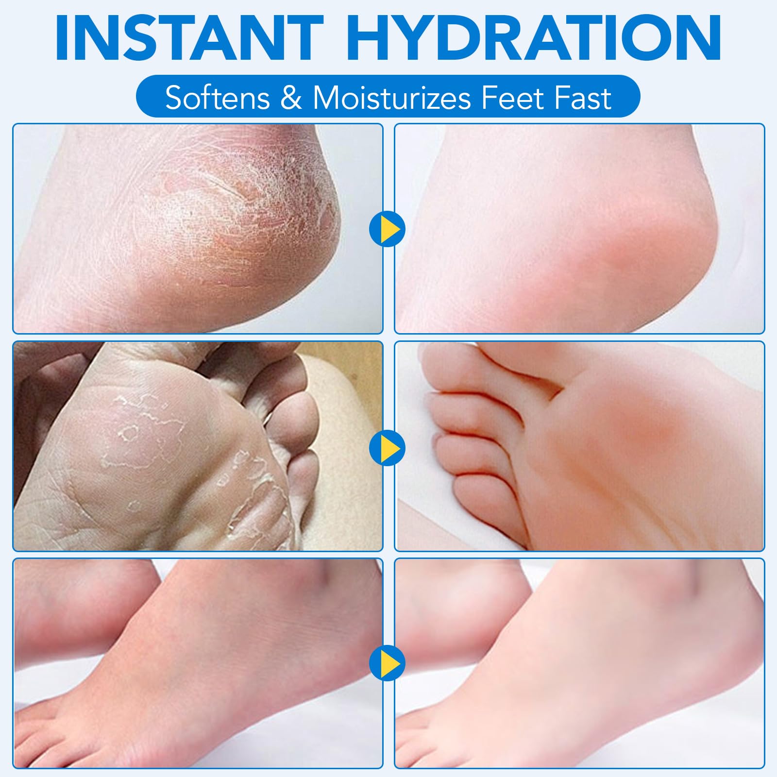 Uruses Crème-urea60 usage quotidien peau douce hydratée.