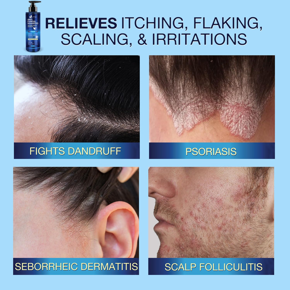 Uttse anti-fungal shampoo lathering into rich foam for gentle cleansing.