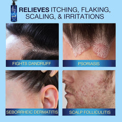 Uttse anti-fungal shampoo lathering into rich foam for gentle cleansing.