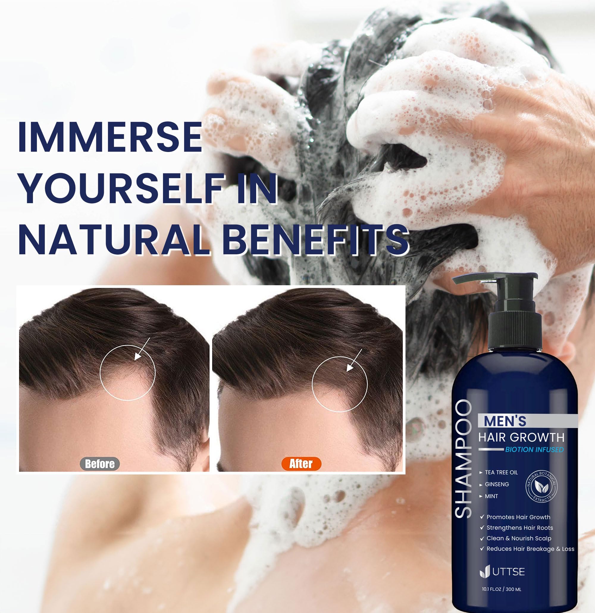 Uttse Shampoing Biotine: soulage cuir chevelu et favorise une croissance saine.