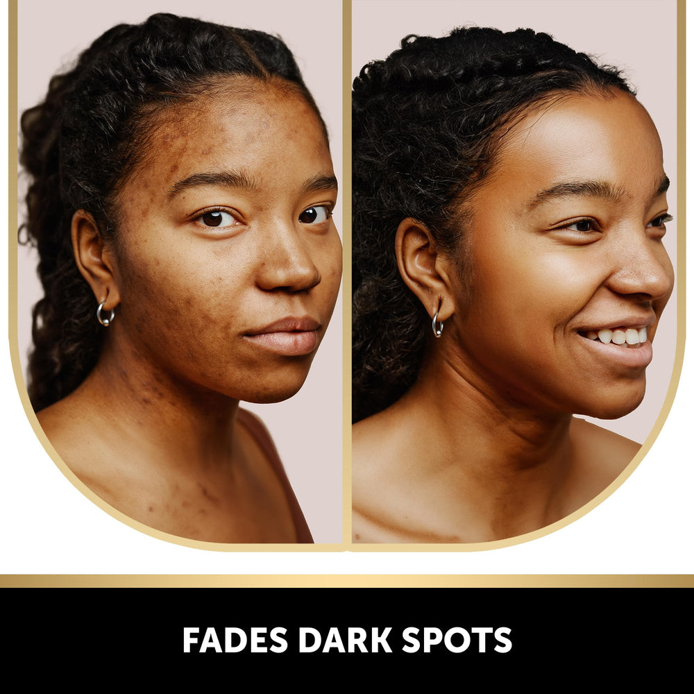 VALITIC savon acide kojique en mousse — texture crémeuse et douceur cutanée